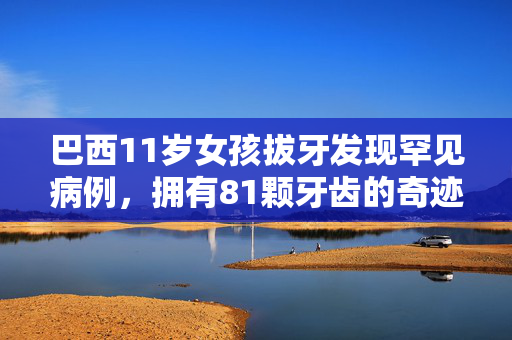 巴西11岁女孩拔牙发现罕见病例，拥有81颗牙齿的奇迹